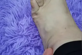 最近这几个月脚上长了个包。很硬，用力按也有点痛视频封面