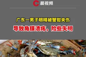 广东一男子眼睛被蟹钳夹伤，导致角膜溃疡，险些失明！医生提醒：被海鲜、河鲜扎伤应及时前往医院就诊