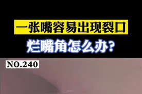 #医学科普 口角炎，一张开嘴容易出现裂口，影响生活，有时候吃饭和说话都不敢长大嘴。#烂嘴角 #口角炎 视频封面