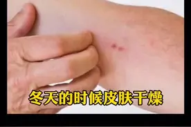 小腿干燥、起皮、还很痒，可以这么处理。#皮肤 #皮肤干燥 #医学科普视频封面