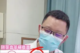 认识单脐动脉#脐带#医学科普 #健康 #健康科普 #诊室日常 #怀孕 #科普 #产检 #重医产科 #黄帅医生 视频封面
