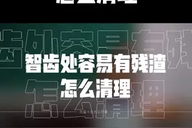 #口腔科普小常识 #智齿拔除 #医学科普 #智齿 智齿处有残渣怎么清理视频封面