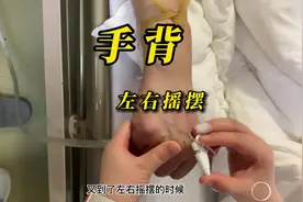 留置针穿刺日常分享……手背，血管选择的左右摇摆#护士 #留置针视频封面
