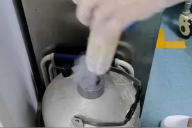 液氮冷冻治疗寻常疣#医学科普 #皮肤健康 