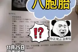 #孕妇怀上罕见八胞胎 家人们喜忧参半！不舍得全部打掉！考虑减胎！视频封面
