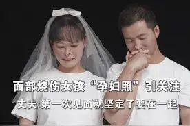面部烧伤女孩孕妇照引关注，丈夫：通过相亲认识，第一次见面就坚定要在一起。视频封面