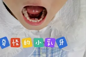 关爱小朋友牙齿健康，不仅要防蛀牙，还要多吃硬的东西，促进牙齿视频封面