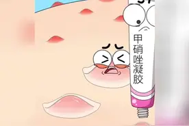 挤痘痘小妙招。#壬二酸#甲硝唑凝胶 #跟黑头粉刺说拜拜