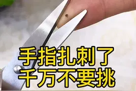 扎刺了取不出来咋办，教你一招，轻松搞定。#生活小妙招