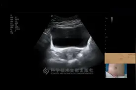 超声教程-产科胎儿超声扫查（下）
#产科 #胎儿  #超声学习视频封面