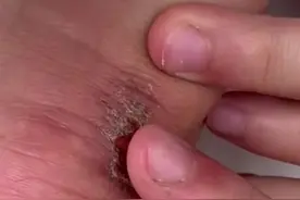 小女孩参观消防站，看见消防员伤痕累累的手，心疼地帮他呼呼。(供稿：慈溪天天)视频封面