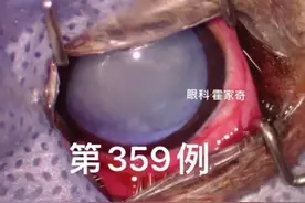 359-363例白内障手术全记录#犬 #白内障视频封面