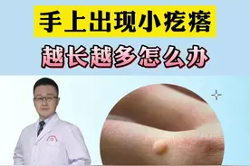 手上长了一个肉疙瘩，可以试试这样处理#寻常疣 #瘊子 #科普 #皮肤 