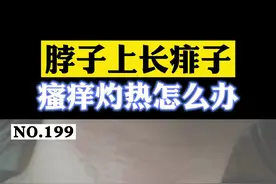 脖子长#痱子 ，一出汗瘙痒加重，怎么办#健康科普 #皮肤 