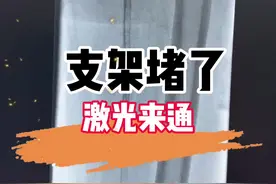 #支架 堵塞，是如何重新开通的？#动脉硬化 #血栓 #医学科普视频封面
