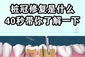 桩冠修复一颗烂牙，一起看看吧#知识合伙人 #dou出新知 #郑州视频封面