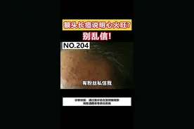 额头#长痘说明心火旺？别乱信！#科普 