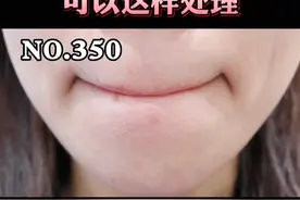 下巴长密集的小白点，不要用手去挤，可以这么办#皮肤 #粉刺 #痘痘 视频封面