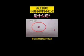 身上出现这些不痛不痒的小红点，是健康出现问题？#辟谣 #科普视频封面