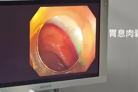 出现的症状：上腹部饱胀不适、 疼痛 、 恶心 、 呕吐 、视频封面