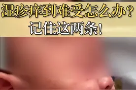 宝宝湿疹很难受怎么办，除了日常的护理， 治疗记住这两点！  #宝宝湿疹  #湿疹护理视频封面