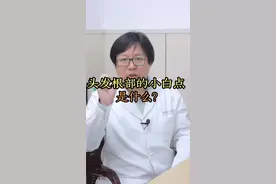 为什么#头发 拔下来根部会有小白点？钟医生告诉你这是什么！