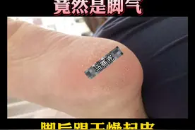 脚后跟干裂起皮，可能并不是#干燥，而是#脚气，会传染，这样处理并不难#科普#联苯苄唑喷雾 视频封面