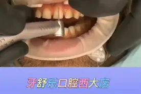 牙缝太大怎么办？补起来就好啦！ #口腔科普 #牙齿