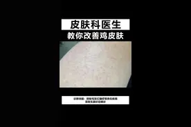 #皮肤#鸡皮肤 视频封面