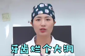 牙齿烂个洞，一直不管它，最后绝对让你后悔#知识产权创造美好生活 #健康真相官 #郑州