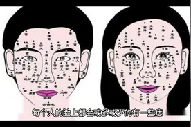 #每天一个小故事#泪痣的传说 #听民间故事品百味人生视频封面