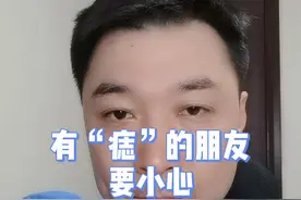 有痣的朋友要注意这三种类型的痣#健康科普 #科普 #干货视频封面