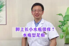 脚上长小水疱，反反复复还痒的厉害#脚气 #医学科普 #脚痒视频封面