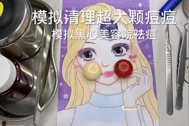场景模拟 模拟清理超大颗痘痘 #场景模拟 #声控助眠