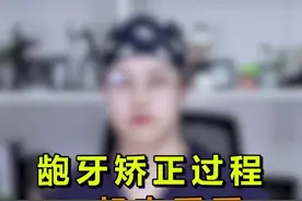 想看龅牙矫正过程的那位小伙伴，今天它来喽#轻知识计划 #dou出新知视频封面