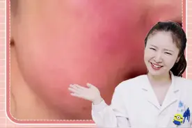 换季皮肤易过敏，敷生理盐水要注意#医学科普 #皮肤科 #朱丁丁视频封面