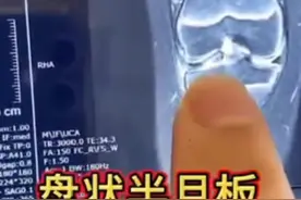 家长们都注意！#9岁娃练拉丁5年半月板严重损伤，医师：不建议太早学习拉丁视频封面