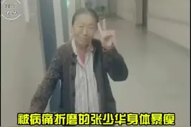 著名演员#张少华去世 生前的她饱受病痛折磨暴瘦，但一直都积极乐观面对，杨志刚谢孟伟得知张少华的离世纷纷为她悼念