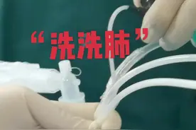 #创作灵感 #呼吸困难 #健康科普 #支气管镜 #@抖音短视频 洗肺 