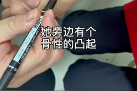 #医学科普 #腕背隆突综合征 #腱鞘囊肿 #手腕疼 @aico视频封面