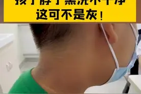 家长们要看好了，这可不是灰！这是黑棘皮症，搓是搓不掉的！跟体重有一定联系，所以要注重孩子的体重问题！#黑棘皮症 视频封面