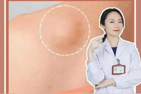 #医学科普 #皮肤 皮肤上的小肉球到底是什么？@抖音短视频视频封面