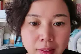 宝宝额头有青筋不要慌，看过来……今晚七点直播间不见不散视频封面
