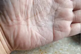 你还别不信，头发又扎进手掌了。视频封面
