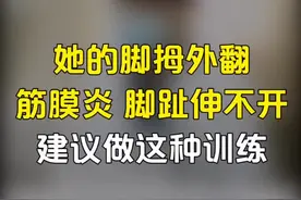 #她 的 #脚 #拇外翻 #筋膜炎 #脚趾 伸不开，建议做这种训练#家庭医生在线 #功能训练视频封面