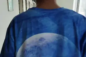 微创修复距腓前韧带术后二个多月复查，能跑能跳！恢复满意！视频封面