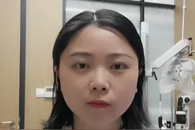 卸妆时眼睛里出现白色的丝状分泌物？👀#眼科科普 #健康科普 #卸妆 #护眼 @DOU+小助手 