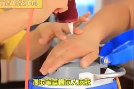 液氮罐厂家讲解怎么使用液氮笔点斑点痣#液氮笔#液氮罐#点斑笔视频封面