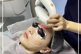 抽空去做了#光子嫩肤 最后有说光电类项目的注意事项哦⚠️#超光子 #m22视频封面