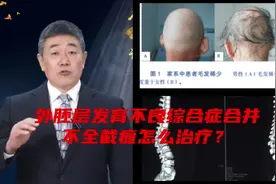 外胚层发育不良综合征合并神经瘫痪怎么办？#脊柱侧弯视频封面
